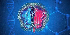 Abstract art of brain with Alzheimer’s Disease